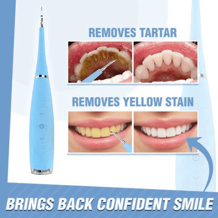 OralCare Ultrasonic Teeth Cleaner (New Colors 2022 Edition)