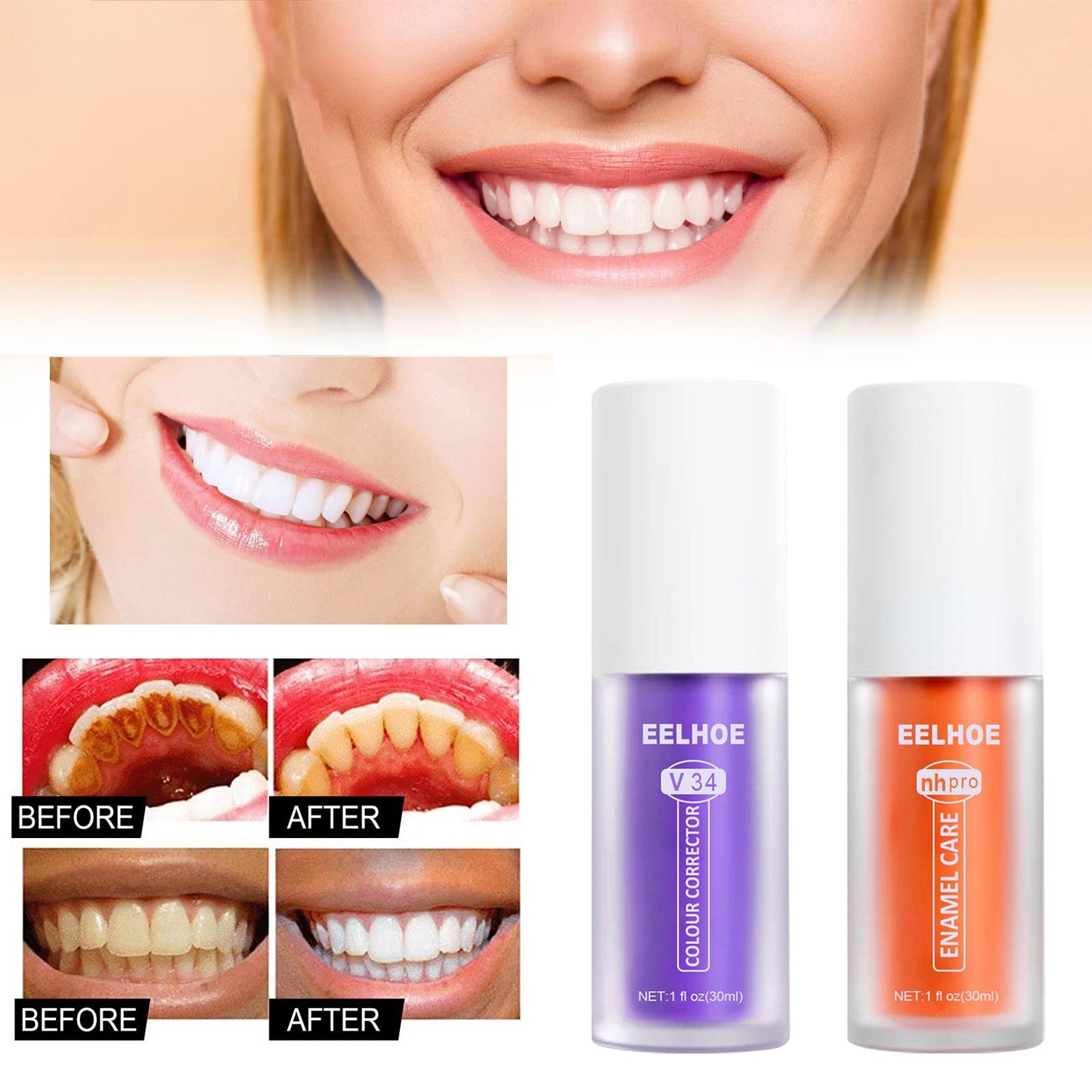 SmileBrite™ Teeth Whitening & Enamel Care Kit