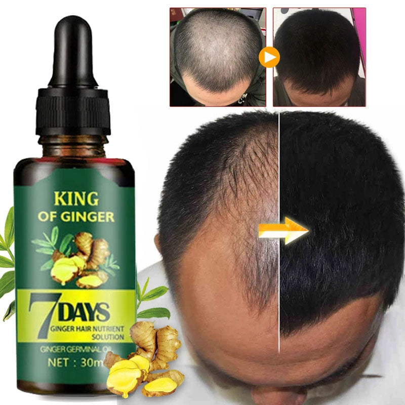 OriginPro Ginger Hair Regrowth Serum