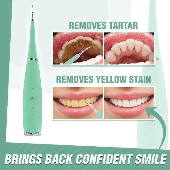 OralCare Ultrasonic Teeth Cleaner (New Colors 2022 Edition)