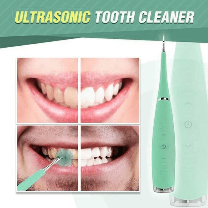OralCare Ultrasonic Teeth Cleaner (New Colors 2022 Edition)