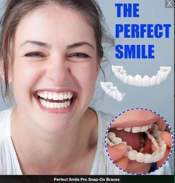 PerfectSmile™ Pro Snap-On Veneers