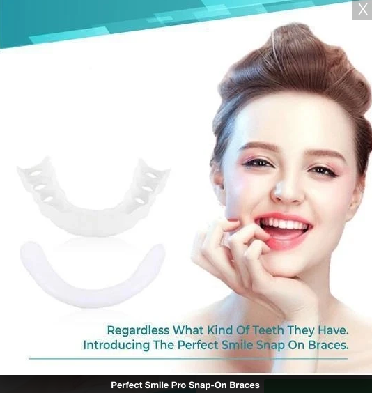 PerfectSmile™ Pro Snap-On Veneers