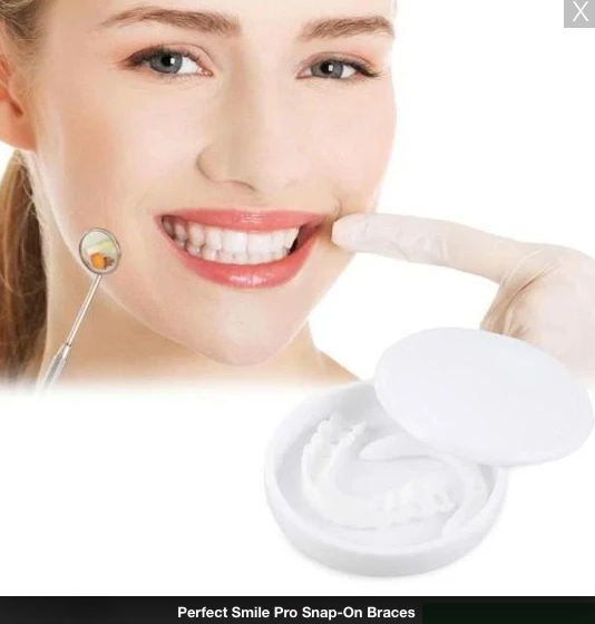 PerfectSmile™ Pro Snap-On Veneers