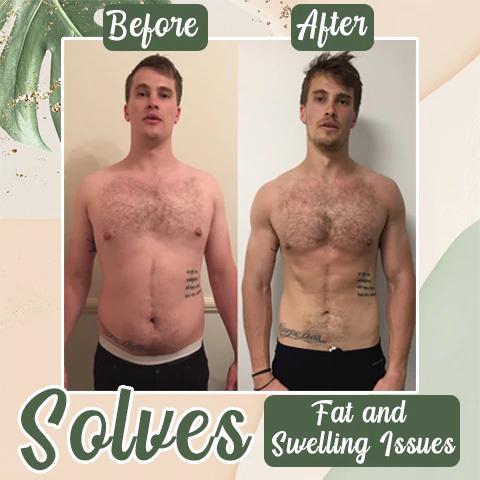 HerbalBurn™ Detox Slimming Patch