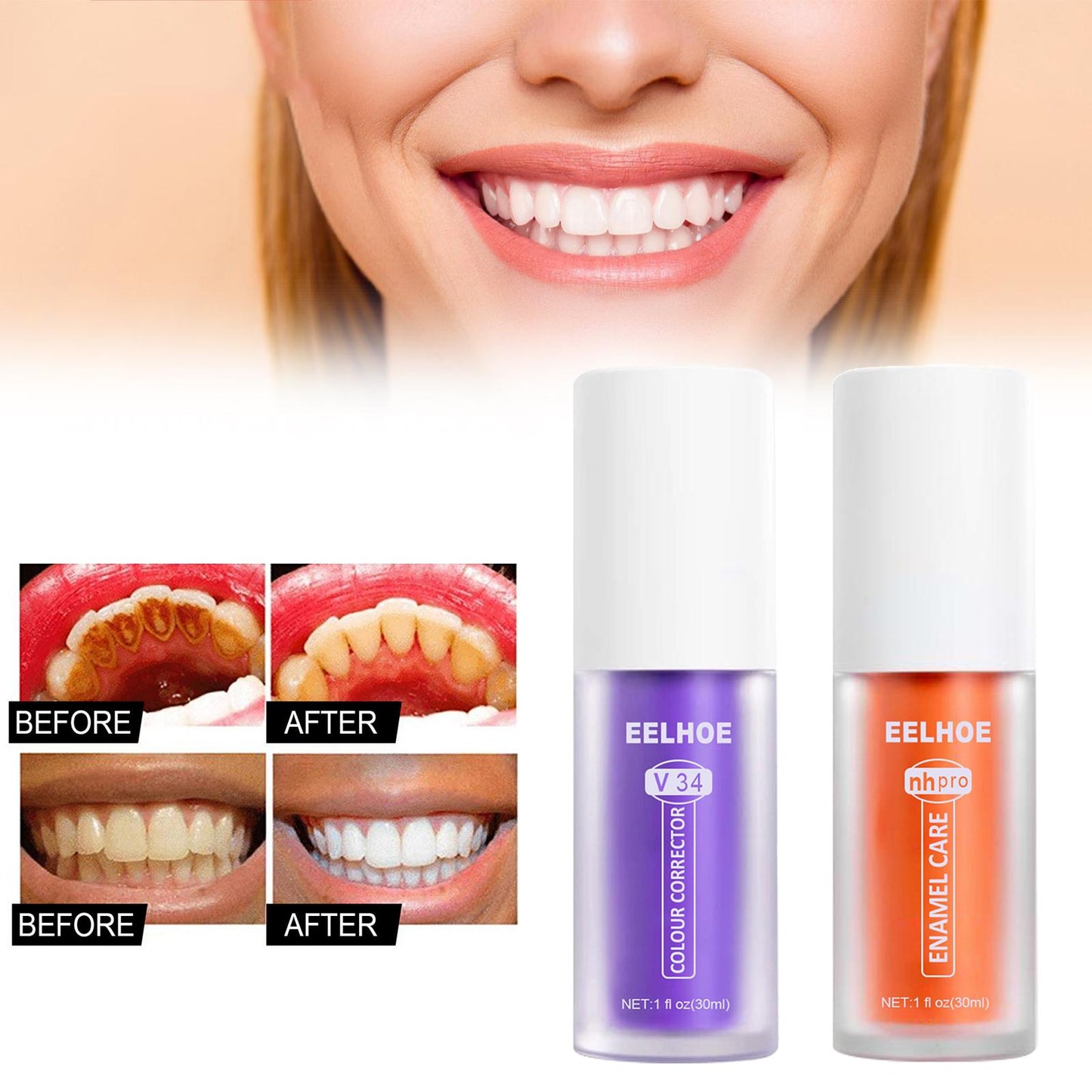 SmileBrite™ Teeth Whitening & Enamel Care Kit