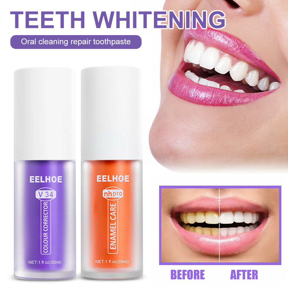 SmileBrite™ Teeth Whitening & Enamel Care Kit
