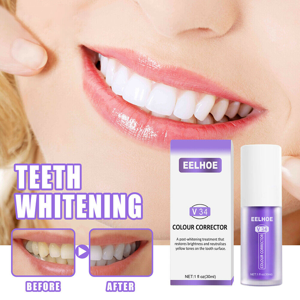 SmileBrite™ Teeth Whitening & Enamel Care Kit